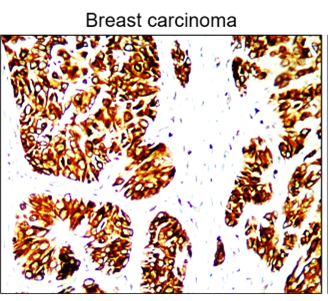 Cytokeratin 5/6 antibody