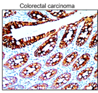 Cytokeratin 7 antibody