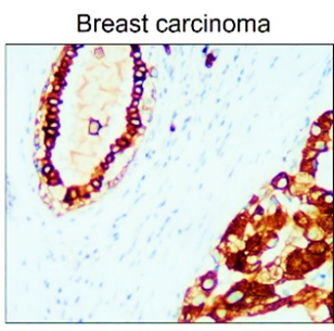 Cytokeratin 8 antibody