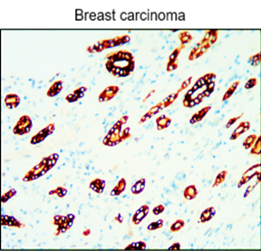 Cytokeratin 18/19 antibody