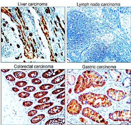 Pan-Cytokeratin antibody