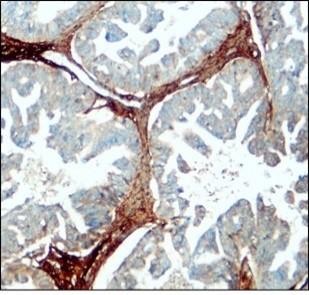 Fibronectin antibody