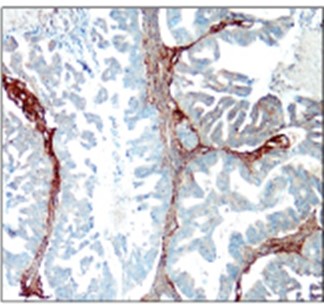 COL1A1 / Collagen I antibody