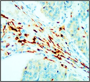 CD45 antibody