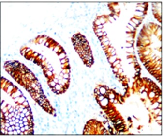 EpCAM antibody (Intracellular)