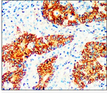 EpCAM antibody (Extracellular)