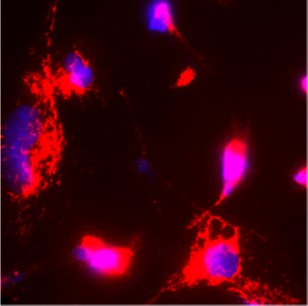 iNOS antibody