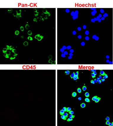 IR222-861-FITC anti-pan Cytokeratin FITC conjugated antibody ICC/IF image