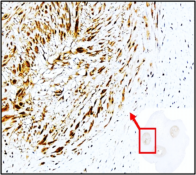 P-selectin_CD62P antibody IHC image