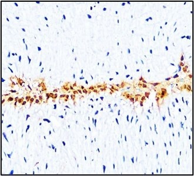 L-selectin_CD62L antibody IHC image