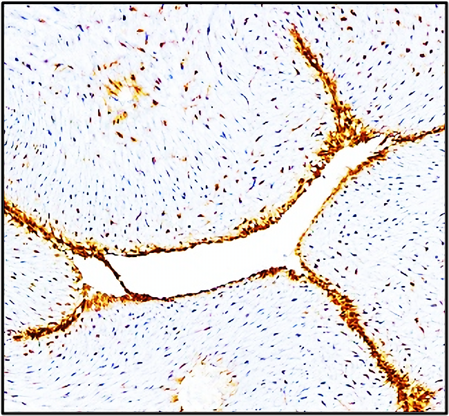 E-selectin_CD62E antibody IHC image