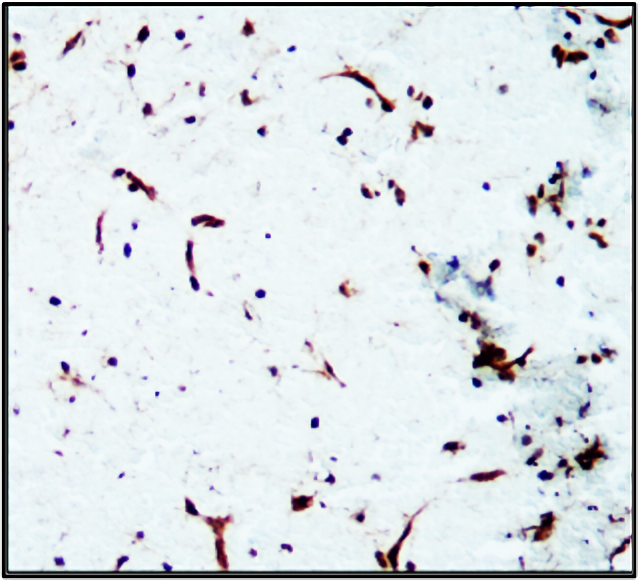 ICAM1 antibody IHC image