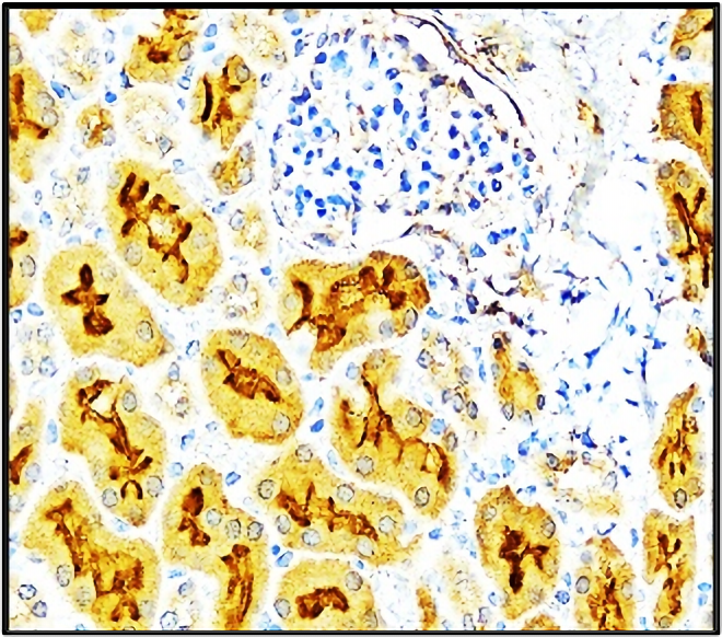 VEGF antibody  IHC image