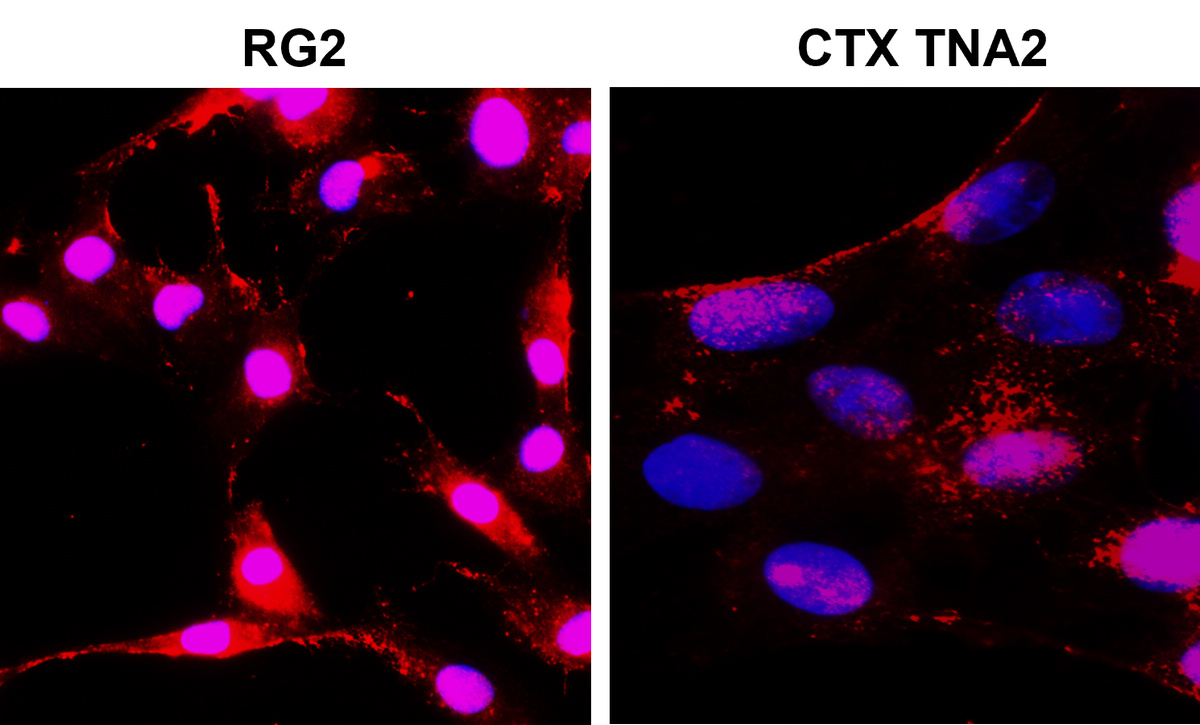 IR7-21 anti-NOTCH1 antibody ICC/IF image