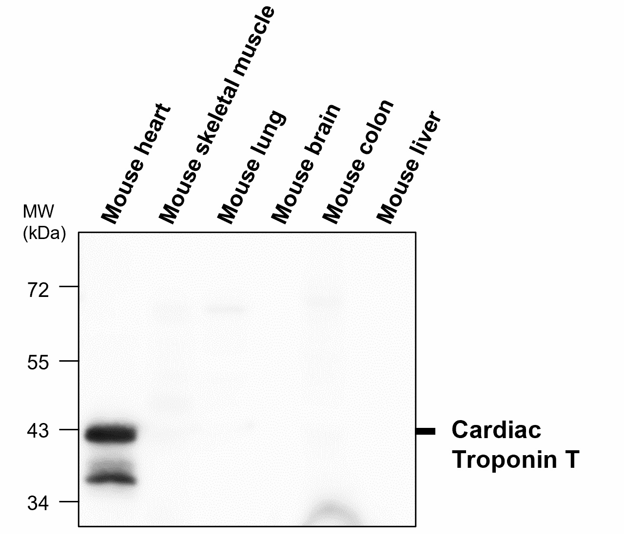 IR293-964 anti-Troponin T, cardiac muscle antibody WB image