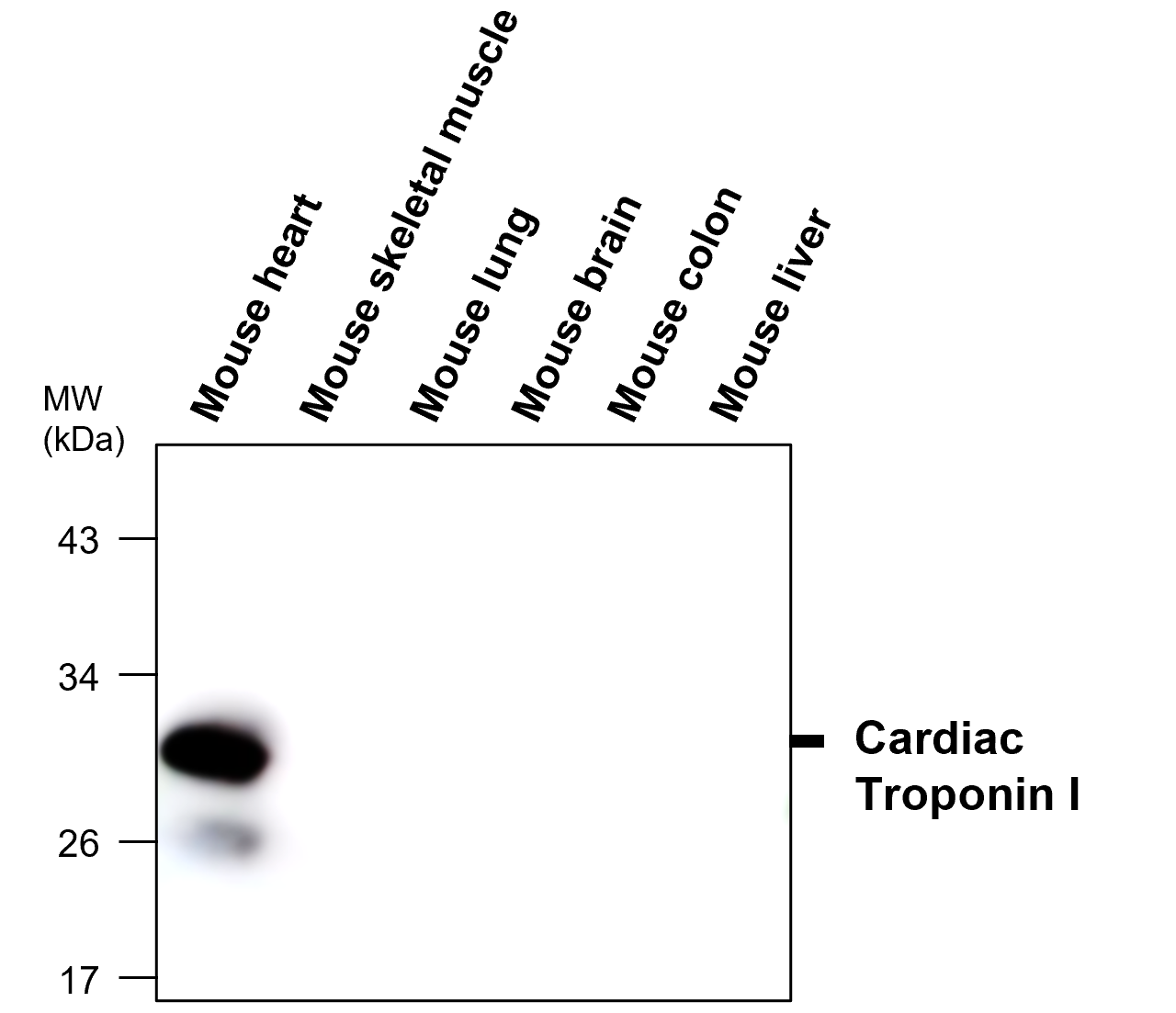 Troponin I, cardiac muscle antibody (IR294-967) | iReal