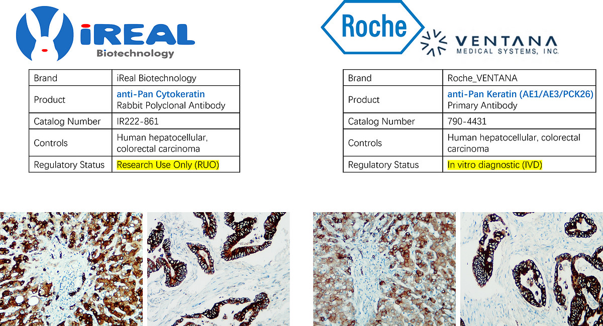 IR222-861 anti-pan Cytokeratin antibody IHC image