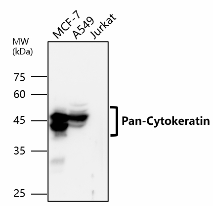 IR222-861 anti-pan Cytokeratin antibody WB image