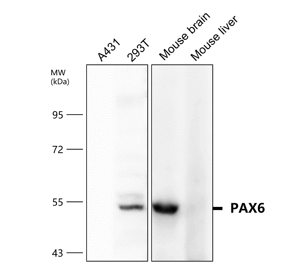 IR6-17 anti-PAX6 antibody WB image