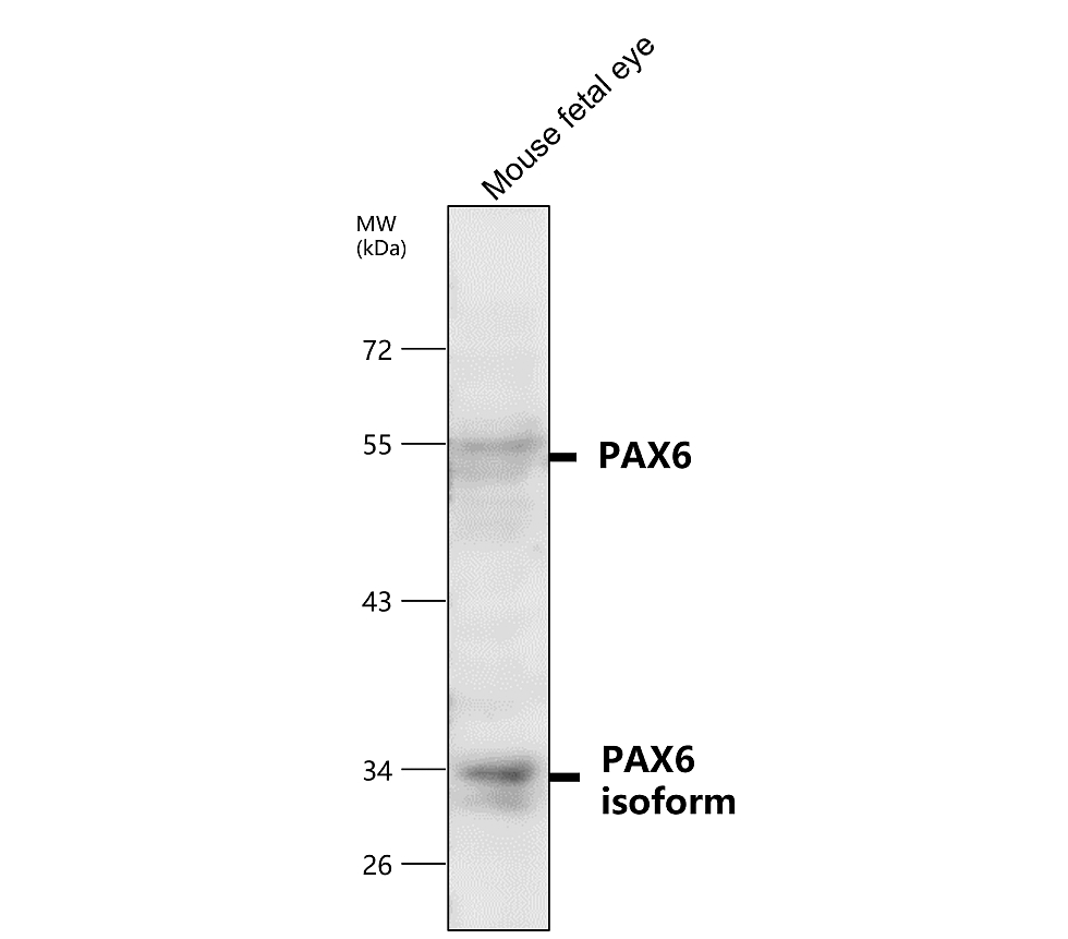 IR6-17 anti-PAX6 antibody WB image