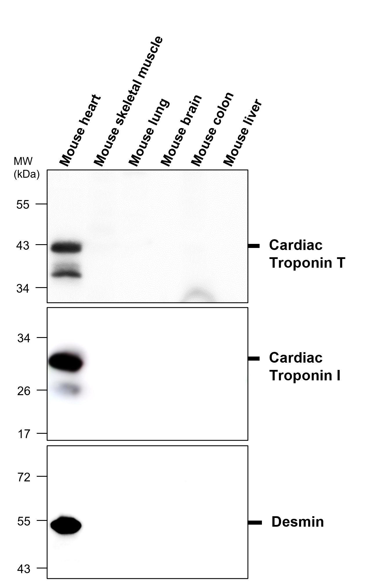 IRM006 anti-Desmin antibody WB image