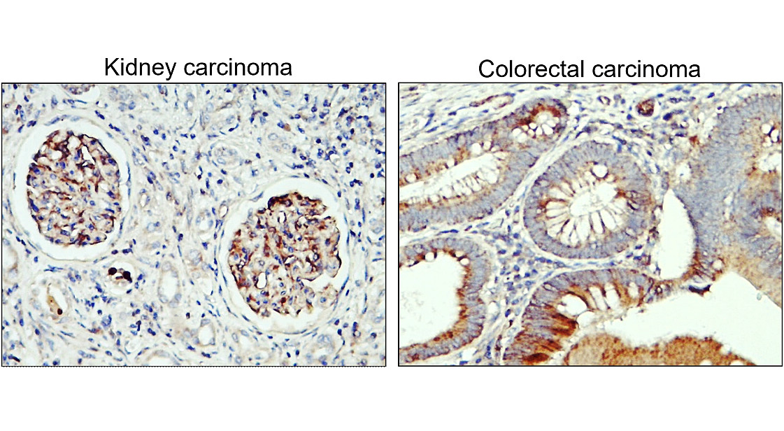 IR8-23 anti-Nestin antibody IHC image