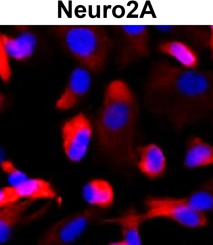 IR8-23 anti- Nestin antibody ICC/IF image