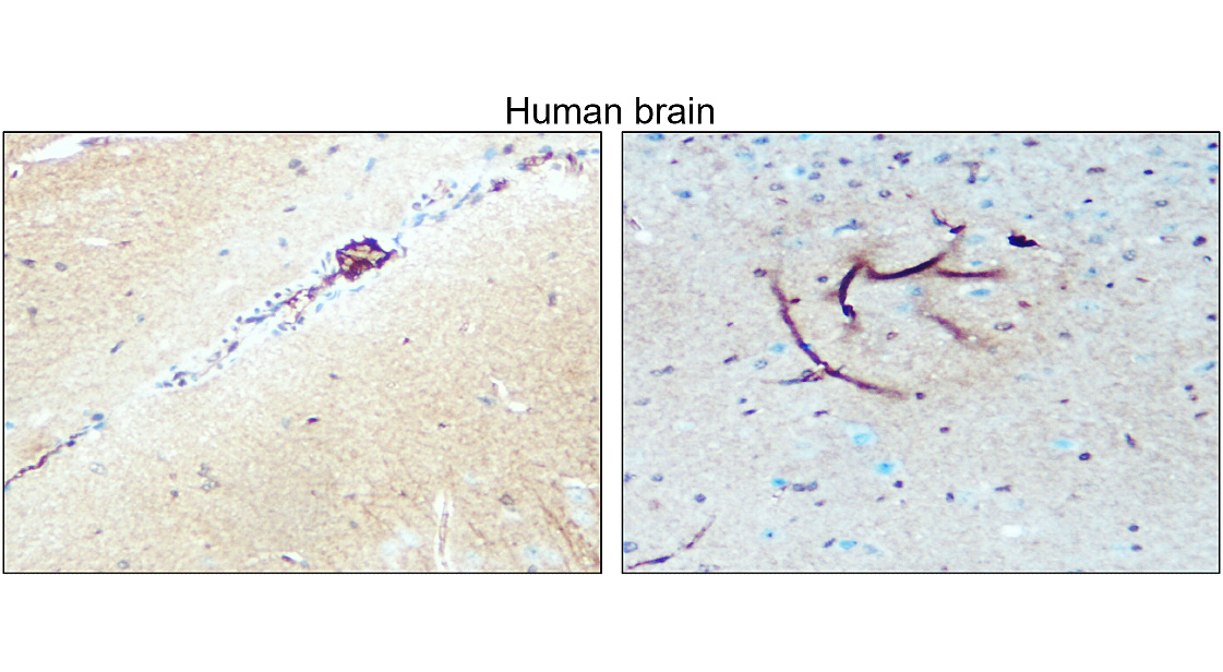 IR8-23 anti-Nestin antibody_Hunan brain IHC image