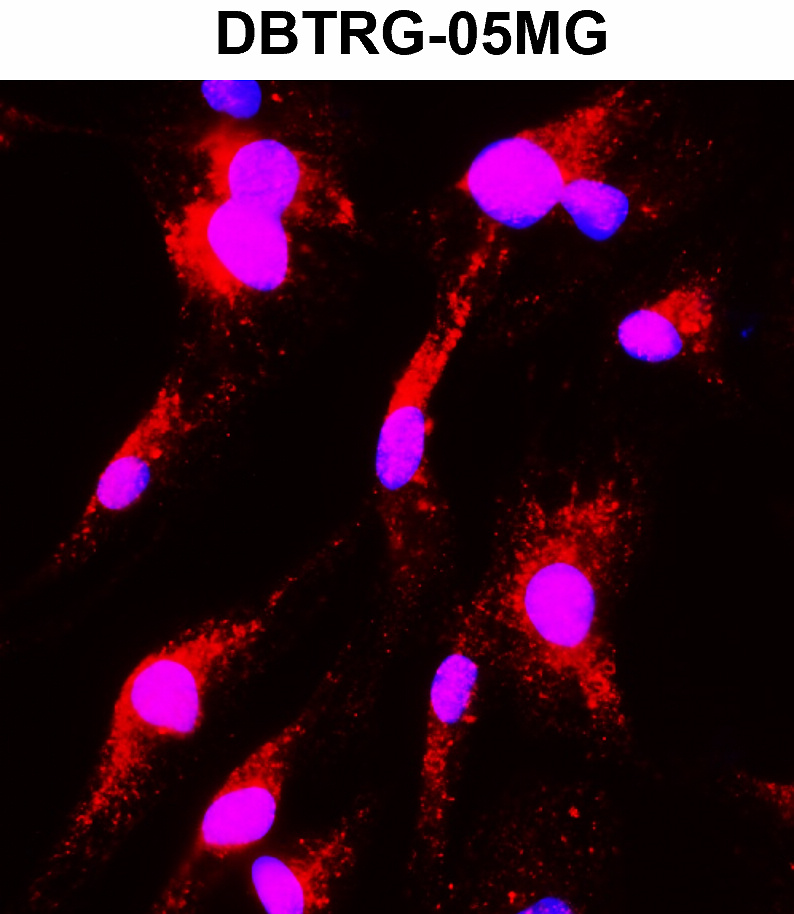 IR12-33 anti-MAP2 antibody ICC image