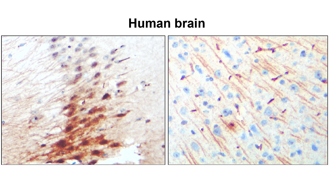 IR12-33 anti-MAP2 antibody_Human brain IHC image