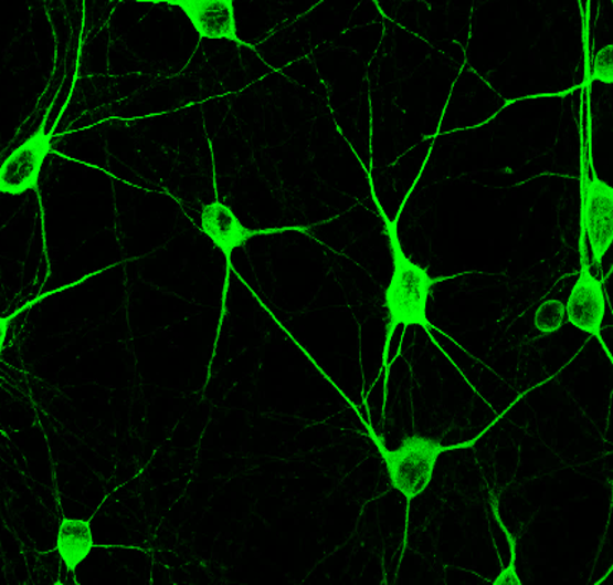 Customer feedback Image IR12-33 anti-MAP2 antibody IF image