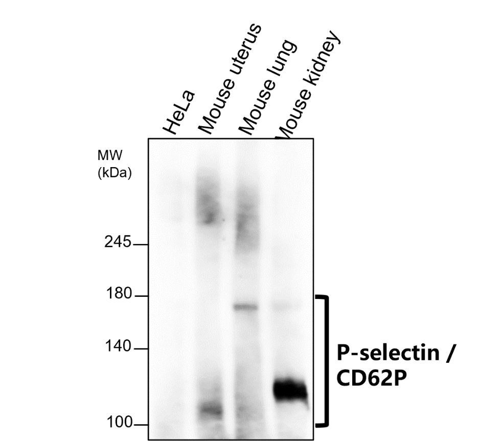 IR307-912 anti P-selectin / CD62P antibody WB image