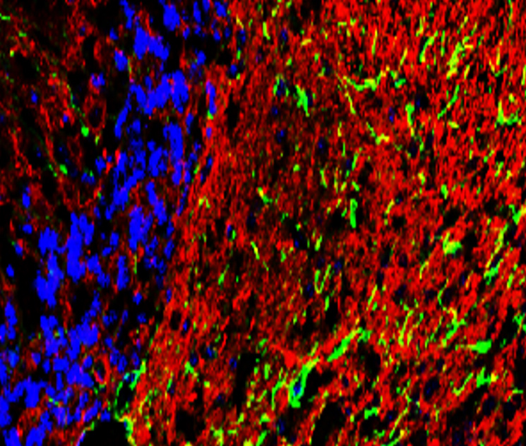 Customer feedback Image IR15-44 anti-GFAP antibody IHC image