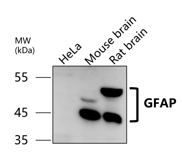 IR15-44 anti-GFAP antibody WB image