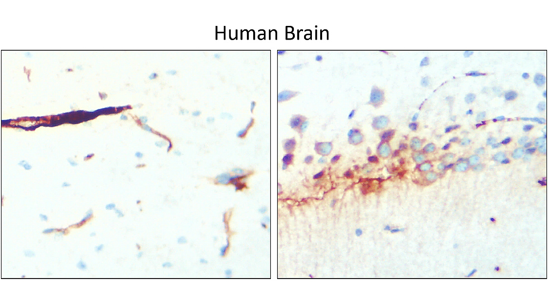 IR15-44 anti-GFAP antibody_Human Brain IHC image