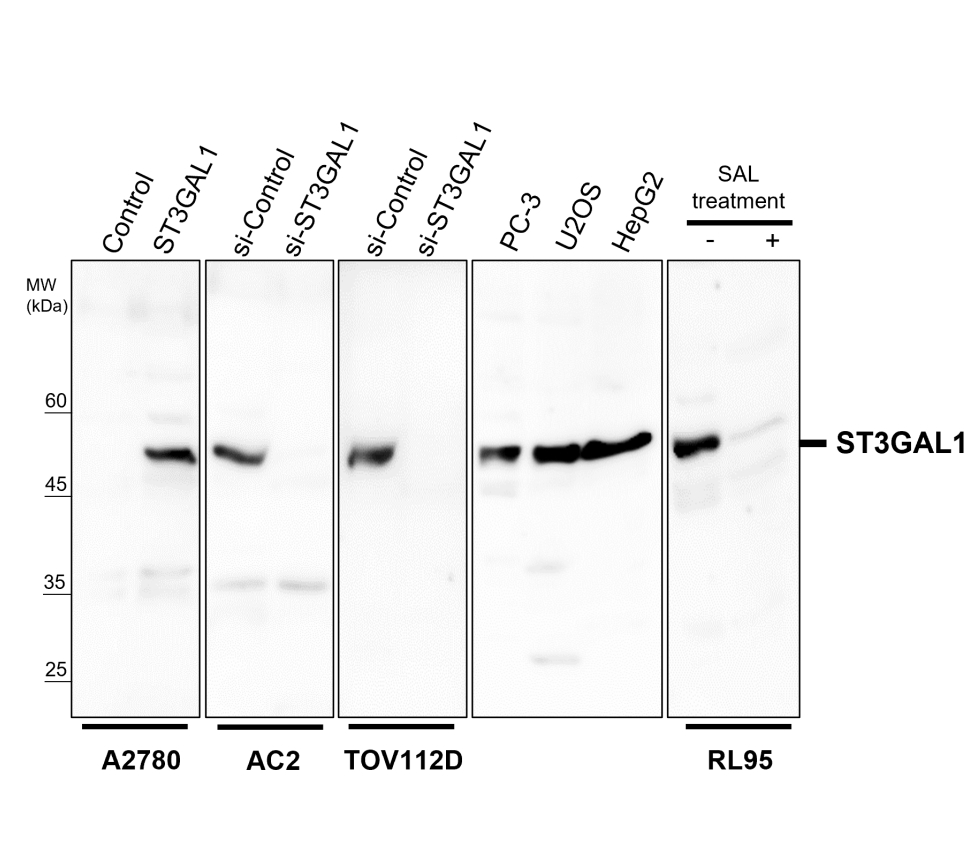 IR297-2 anti-ST3GAL1 antibody WB image