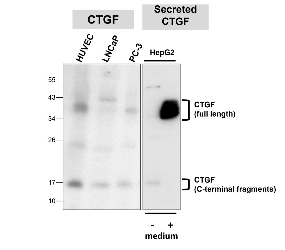 IR289-955 anti-CTGF antibody WB image