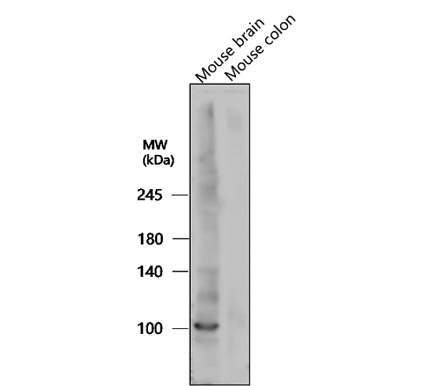 IR38-119 anti-LRRK2 antibody WB image