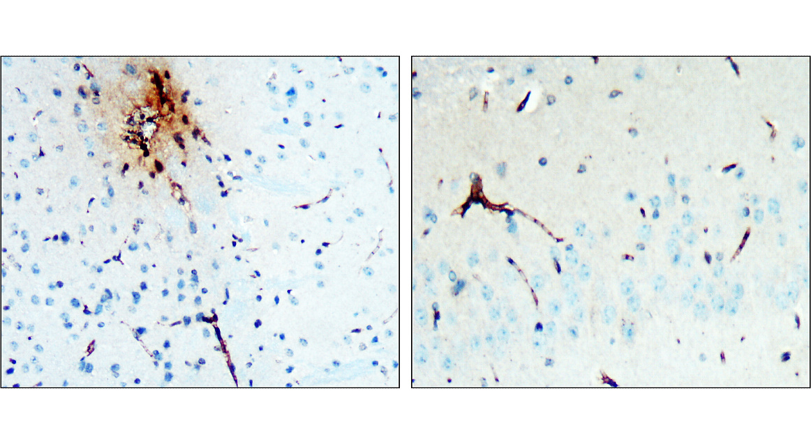 IR38-119 anti-LRRK2 antibody IHC image