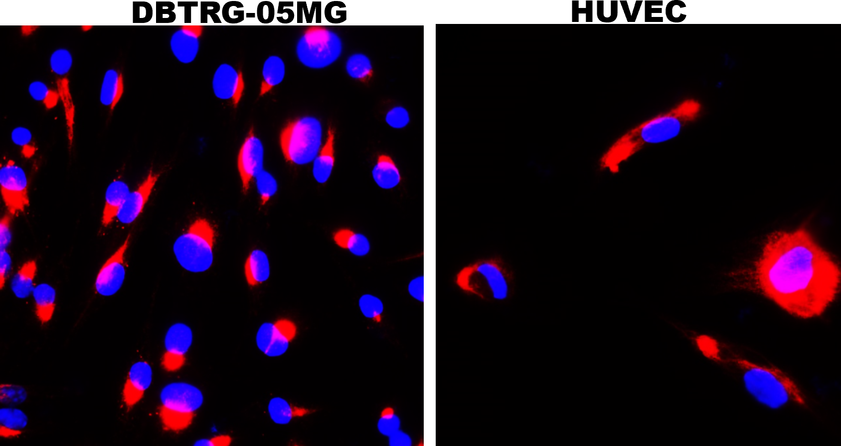 IR38-119 anti-LRRK2 antibody ICC/IF image