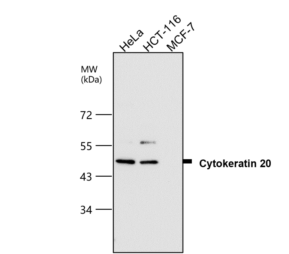 IR238-892 anti-Cytokeratin 20 antibody WB image