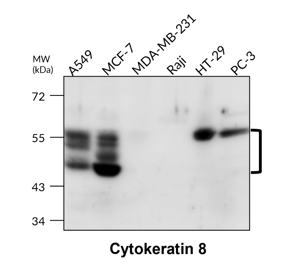 IR229-871 anti-Cytokeratin 8 antibody WB image