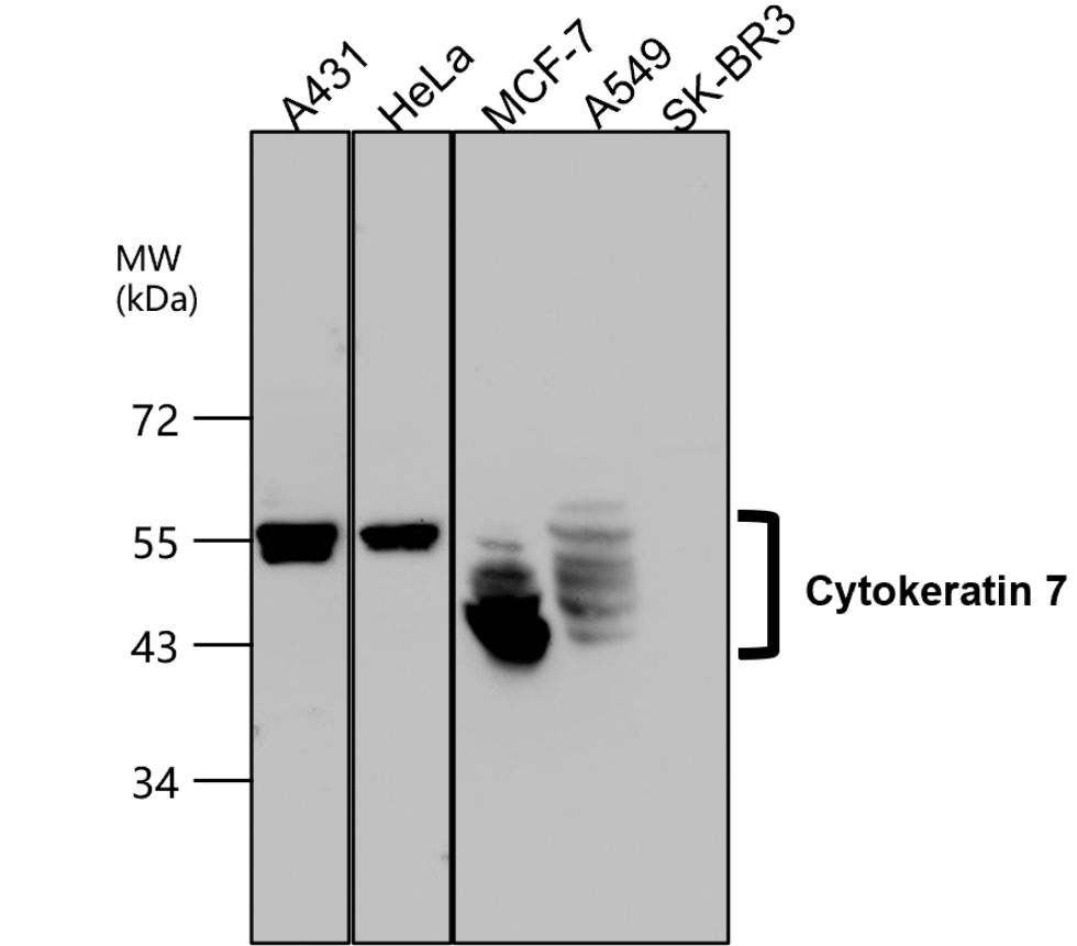 IR228-868 anti-Cytokeratin 7 antibody WB image