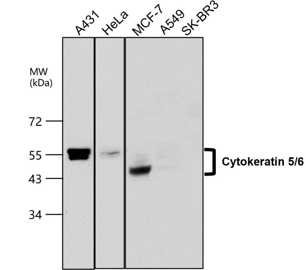 IR226-865 anti-Cytokeratin 5/6 antibody WB image