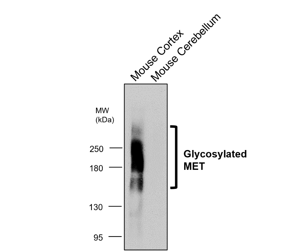 IR219-807 anti c-MET antibody WB image