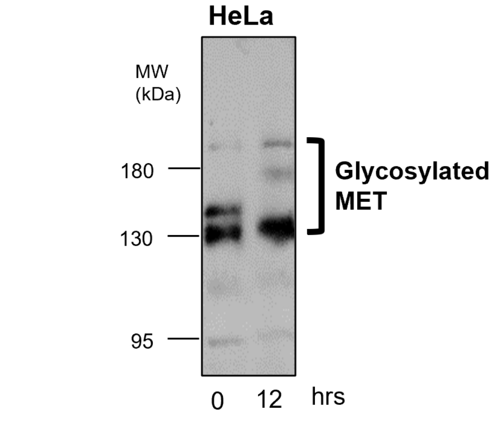 IR219-807 anti c-MET antibody WB image