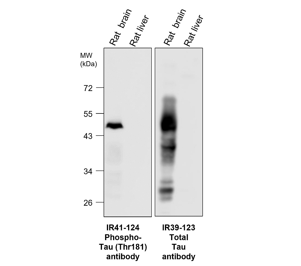 IR41-124 anti-Phospho-Tau (Thr181) antibody WB image