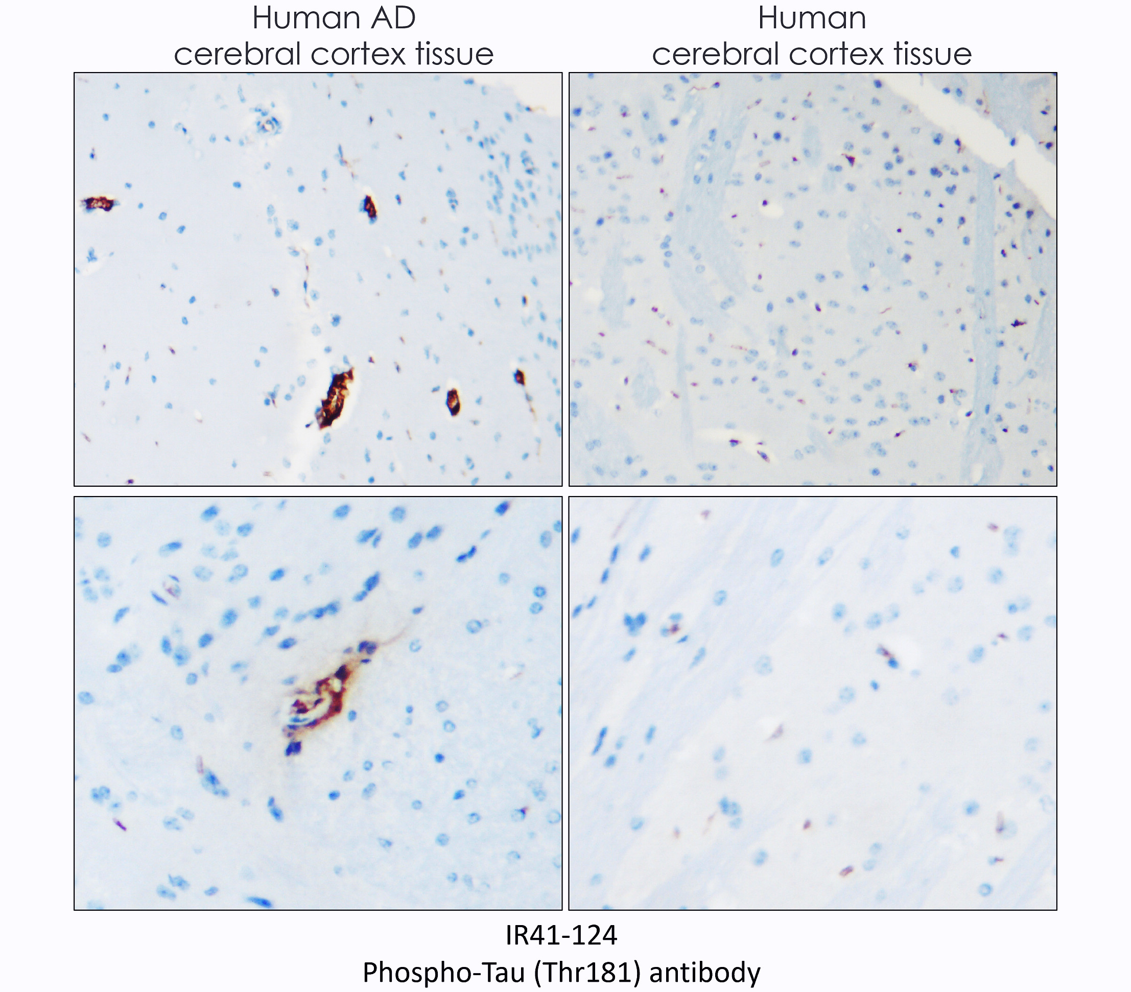 IR41-124 anti-Phospho-Tau (Thr181) antibody IHC image