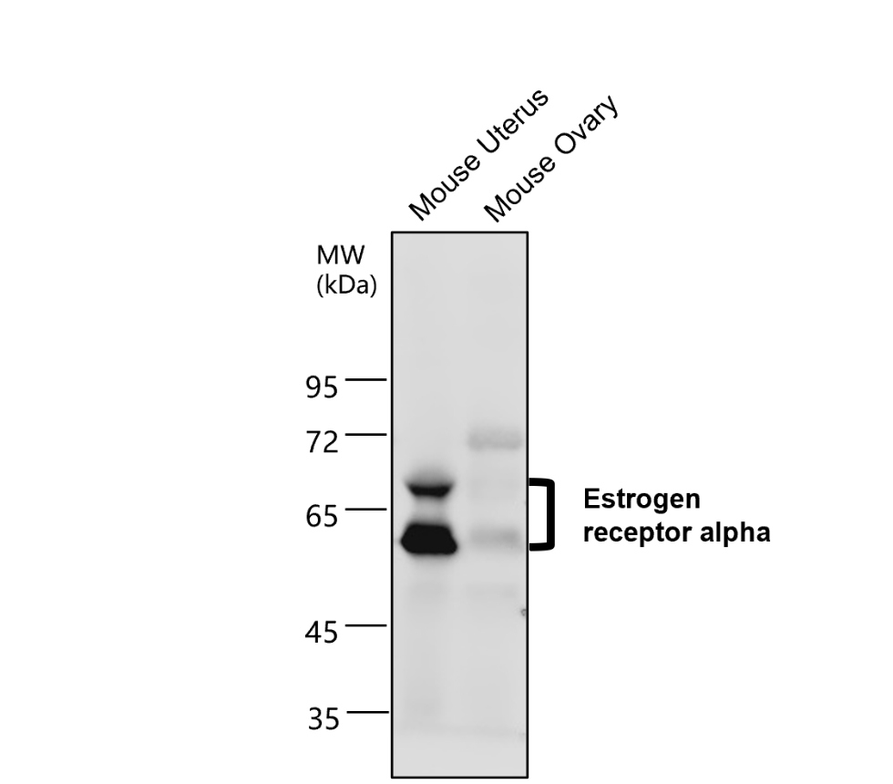 IR213-777 anti- Estrogen Receptor alpha antibody WB image