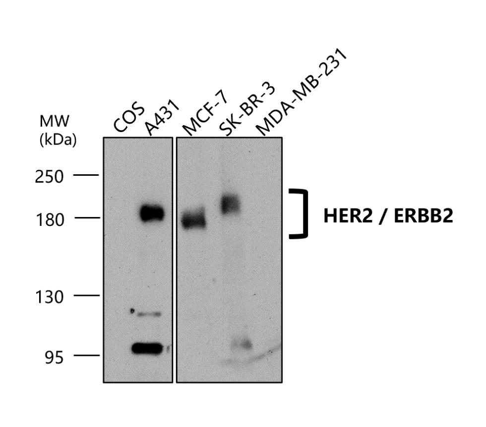 IR210-763 anti-HER2 / ERBB2 antibody WB image